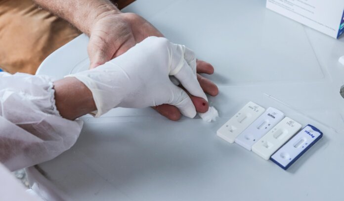 Testagem-IST-Sifilis-3-scaled.jpeg Outubro Verde: Pernambuco reforça importância da prevenção e do diagnóstico precoce da sífilis